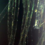 Dark field microscopy of algae