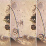Bright field microscopy of living protozoa
